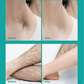 🌿Painless Full Body Hair Removal Cream for Men & Women– Skin-friendly for all areas🌿