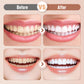 Rechargeable Sonic Electric Toothbrush For Adults